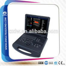 prix echographie doppler couleur &amp; ultraschall farbdoppler scanner DW-C60